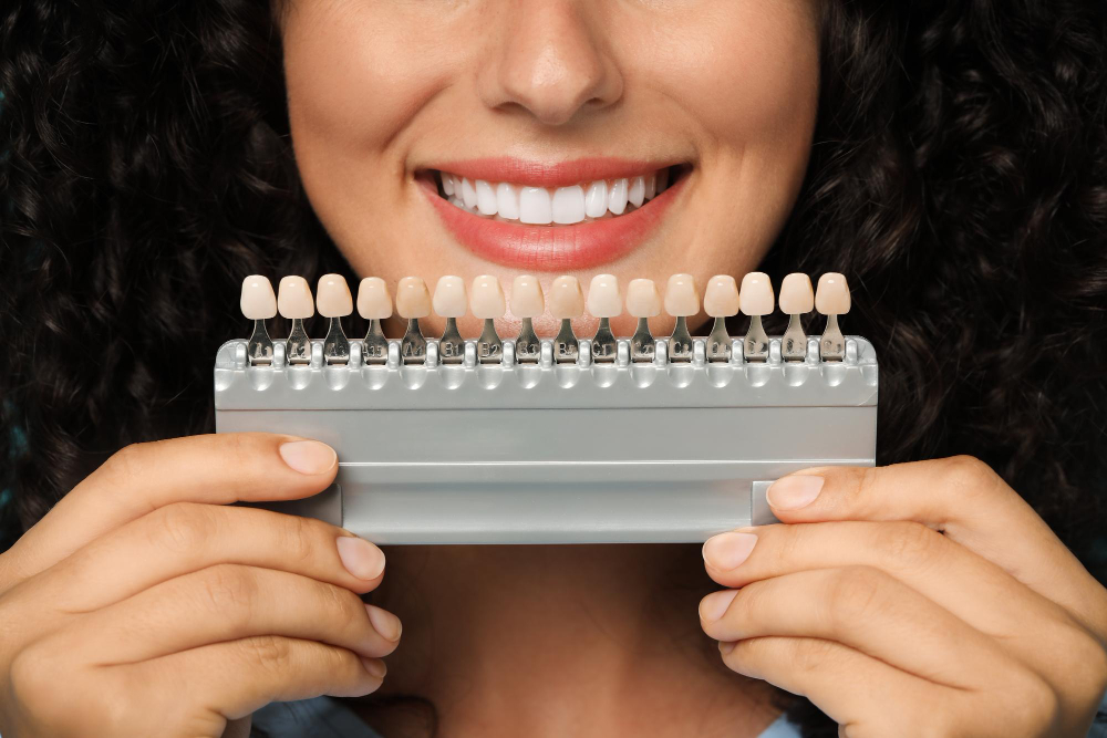 Facetas em resina em Santa Cruz do Rio Pardo: solução estética para transformar o sorriso com naturalidade