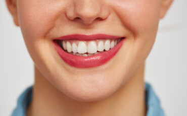 Imagem em Destaque - Especialista em gengivoplastia em Chavantes: harmonize seu sorriso com procedimento estético e acompanhamento profissional