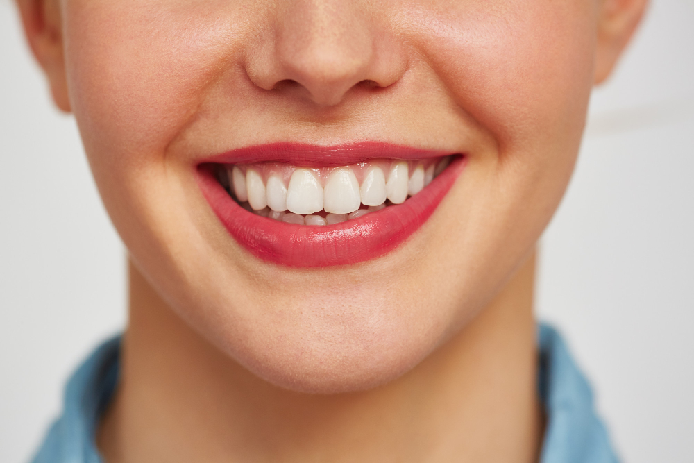 Especialista em gengivoplastia em Chavantes: harmonize seu sorriso com procedimento estético e acompanhamento profissional