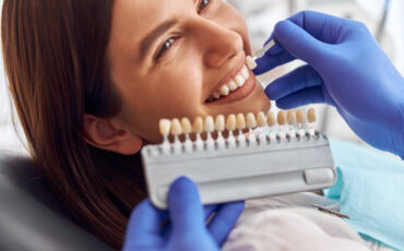 Imagem em Destaque - Facetas de porcelana em Bernardino de Campos: transforme seu sorriso com estética natural e acabamento sofisticado