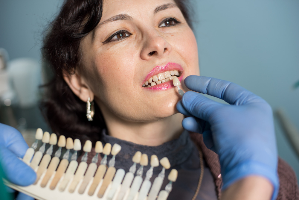 Facetas de porcelana em Canitar: solução estética para transformar o sorriso com naturalidade e sofisticação