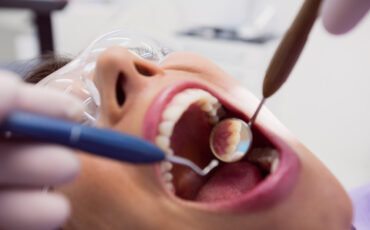 Imagem em Destaque - Tratamento de canal em Manduri: procedimento especializado para aliviar dores e preservar o dente