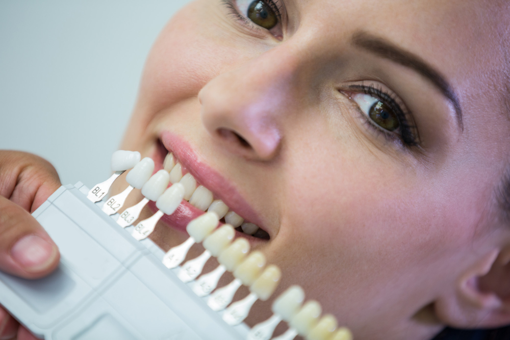 Lentes de contato dental em Ribeirão Claro: tratamento estético para conquistar um sorriso mais harmônico e natural