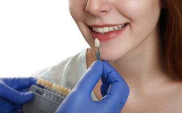 Imagem em Destaque - Facetas de porcelana: quando esse tratamento é a melhor opção para transformar o seu sorriso