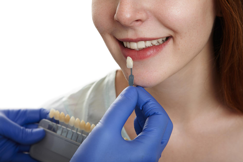 Facetas de porcelana: quando esse tratamento é a melhor opção para transformar o seu sorriso