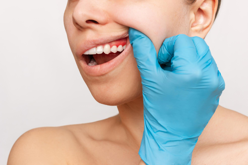 Gengivoplastia em Ourinhos: descubra quando o procedimento é indicado e como escolher um especialista